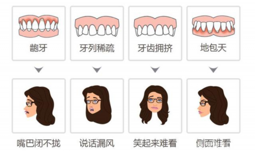 冰瓷美牙是什么（冰瓷美牙广告）(图1)
